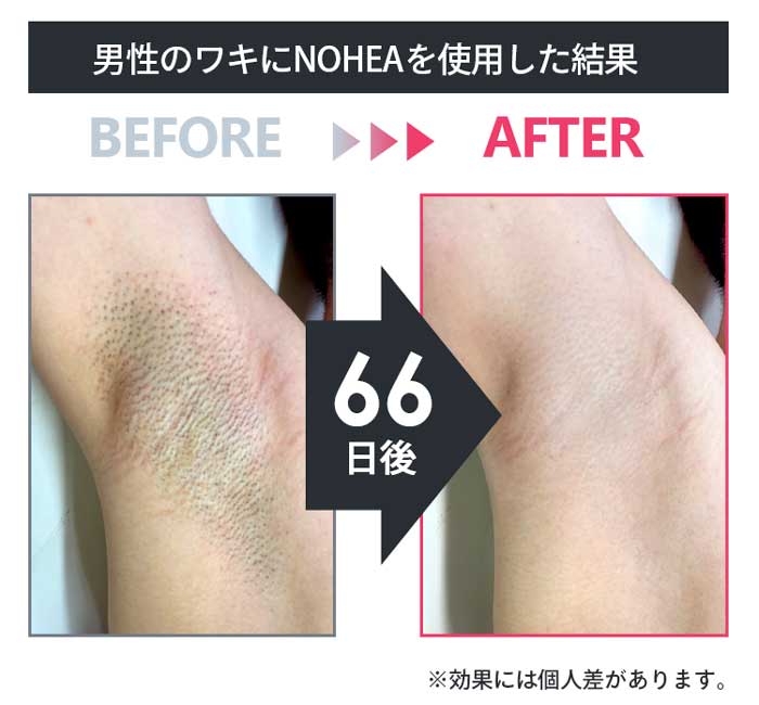 使用した結果